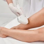 la formation socle illustrée par une épilation au laser, lumière pulsée